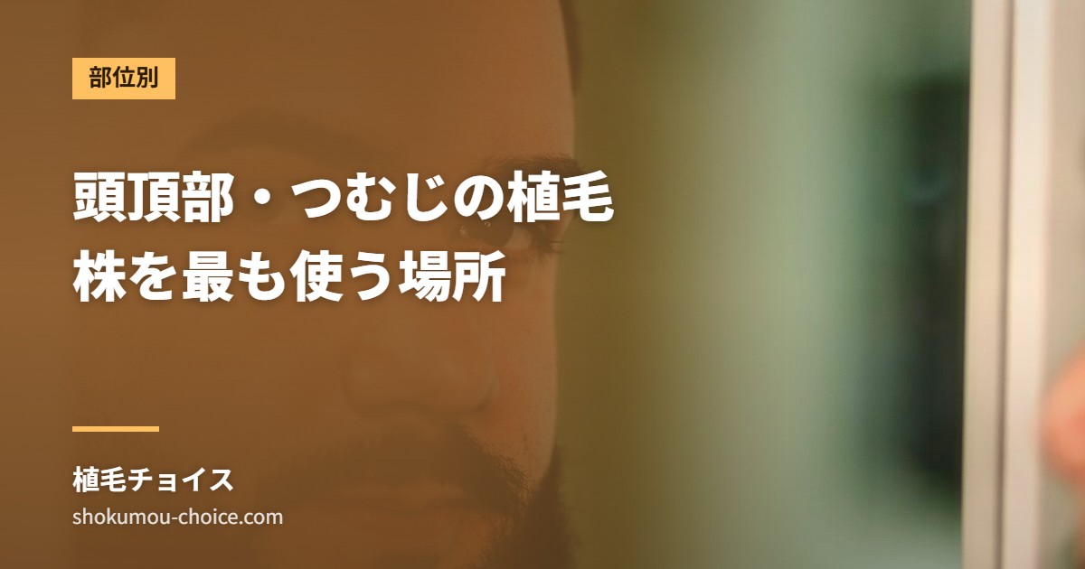 頭頂部・つむじの植毛 株を最も使う場所