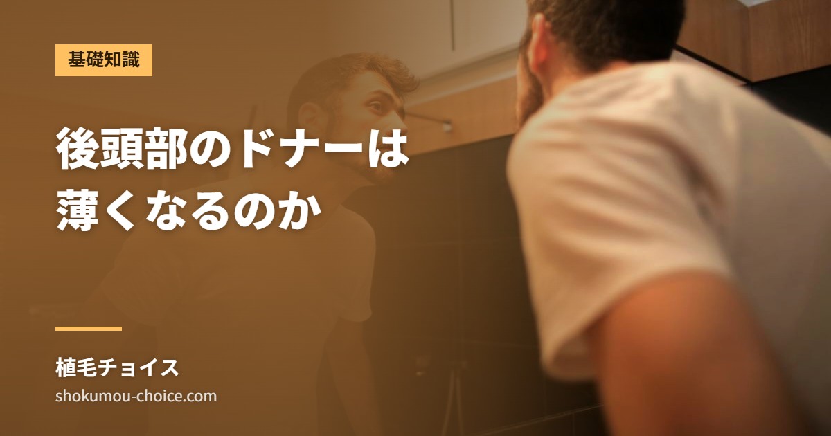 後頭部のドナーは 薄くなるのか