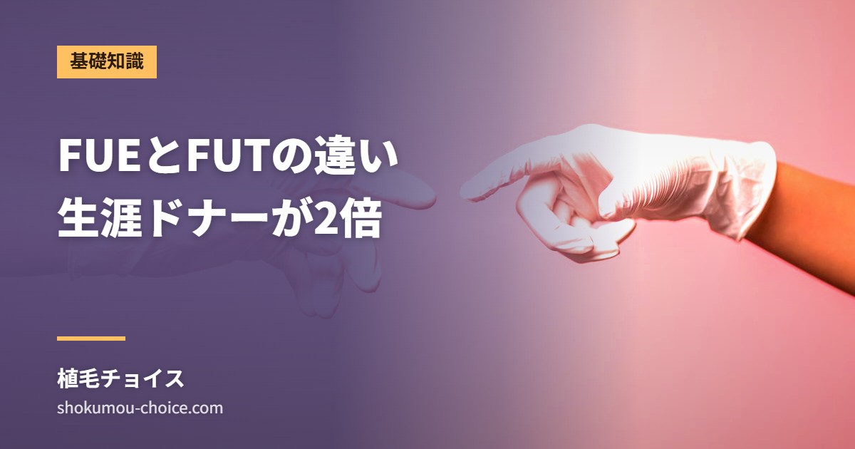 FUEとFUTの違い 生涯ドナーが2倍