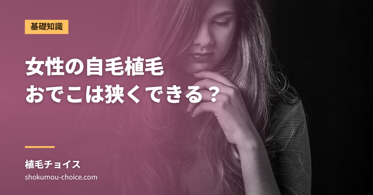 女性の自毛植毛 おでこは狭くできる？