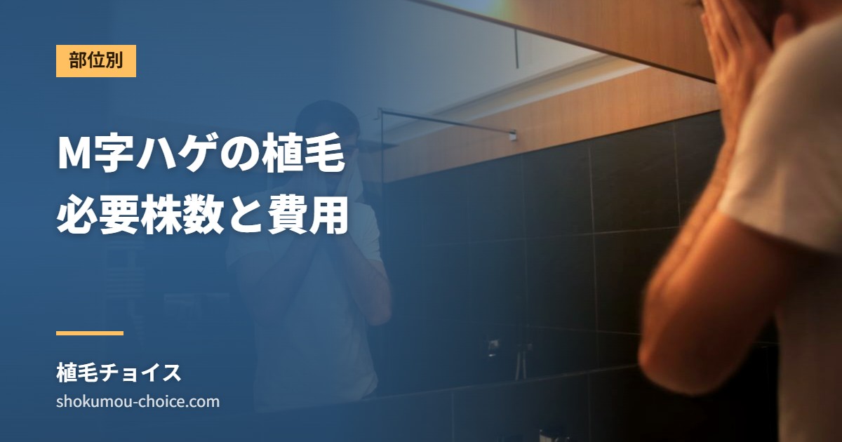 M字ハゲの植毛 必要株数と費用