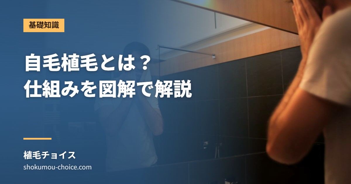 自毛植毛とは？ 仕組みを図解で解説